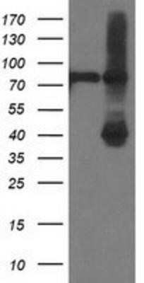 Western Blot: alcohol dehydrogenase 1B Antibody (OTI4F12)Azide and BSA Free [NBP2-70092]