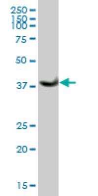 Western Blot: alcohol dehydrogenase 1B Antibody [H00000125-B01P]