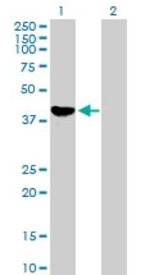 Western Blot: alcohol dehydrogenase 1C Antibody [H00000126-B01P]