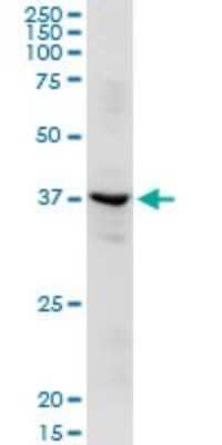 Western Blot: alcohol dehydrogenase 1C Antibody [H00000126-D01P]