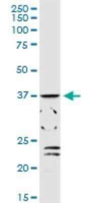 Western Blot: alcohol dehydrogenase 1C Antibody [H00000126-D01P]