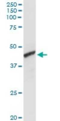 Western Blot: alcohol dehydrogenase 1C Antibody [H00000126-D01P]