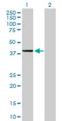 Western Blot: alcohol dehydrogenase 1C Antibody [H00000126-D01P]