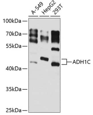 Western Blot: alcohol dehydrogenase 1C AntibodyBSA Free [NBP2-92824]