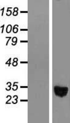 Western Blot: alcohol dehydrogenase 1C Overexpression Lysate [NBL1-07336]