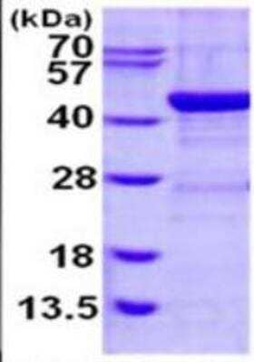 SDS-PAGE: Recombinant Human alcohol dehydrogenase 1C His Protein [NBP1-98936]