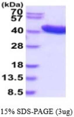 SDS-PAGE: Recombinant Human alcohol dehydrogenase 1C His Protein [NBP2-53078]