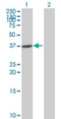 Western Blot: alcohol dehydrogenase 4 Antibody [H00000127-B01P]
