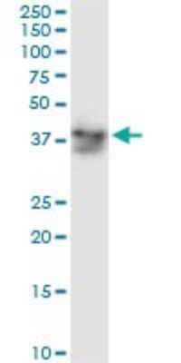 Western Blot: alcohol dehydrogenase 5 Antibody (12F7) [H00000128-M01]