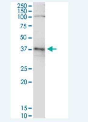 Western Blot: alcohol dehydrogenase 5 Antibody (2D11) [H00000128-M12-100ug]