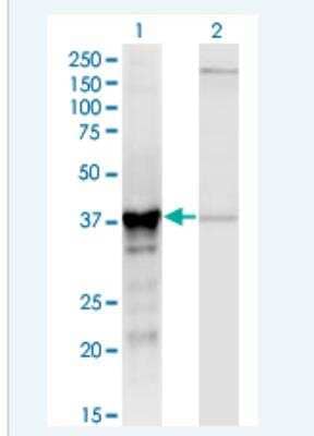 Western Blot: alcohol dehydrogenase 5 Antibody (2D11) [H00000128-M12-100ug]