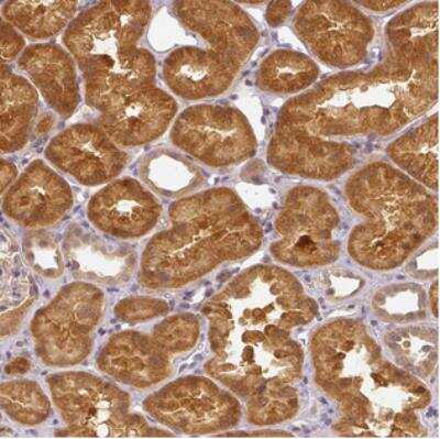 Immunohistochemistry-Paraffin: alcohol dehydrogenase 5 Antibody [NBP2-30636]