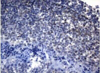 Immunohistochemistry: alcohol dehydrogenase 5 Antibody (OTI5G4) - Azide and BSA Free [NBP2-70096]
