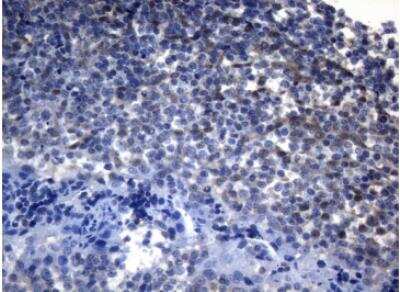 Immunohistochemistry-Paraffin: alcohol dehydrogenase 5 Antibody (OTI5G4) [NBP2-46495]