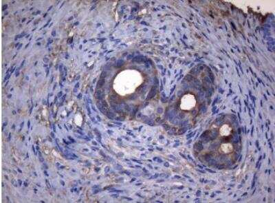 Immunohistochemistry-Paraffin: alcohol dehydrogenase 5 Antibody (OTI5G4) [NBP2-46495]