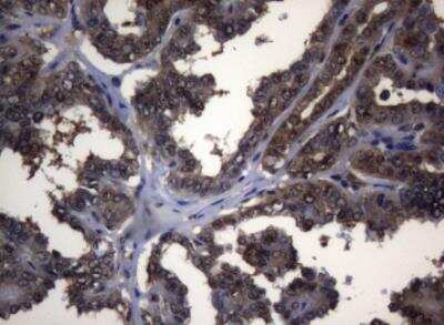 Immunohistochemistry-Paraffin: alcohol dehydrogenase 5 Antibody (OTI5G4) [NBP2-46495]