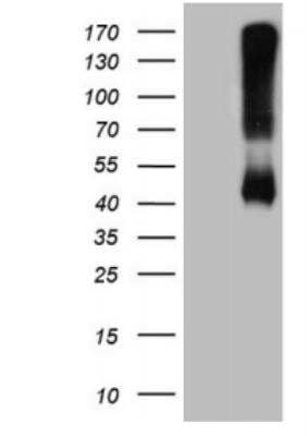 Western Blot: alcohol dehydrogenase 5 Antibody (OTI5G4) [NBP2-46495]