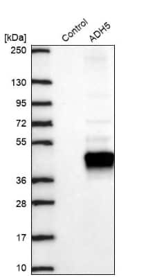 Western Blot: alcohol dehydrogenase 5 Antibody [NBP2-49350]