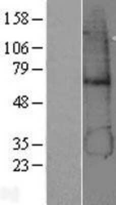 Western Blot: alcohol dehydrogenase 5 Overexpression Lysate [NBP2-04170]