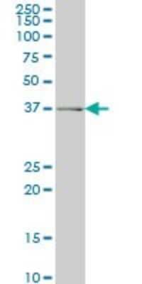 Western Blot: alcohol dehydrogenase 6 Antibody (4G4) [H00000130-M01]