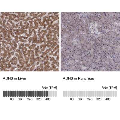 Immunohistochemistry-Paraffin: alcohol dehydrogenase 6 Antibody [NBP2-62658]