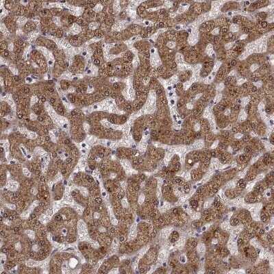 Immunohistochemistry-Paraffin: alcohol dehydrogenase 6 Antibody [NBP2-62658]
