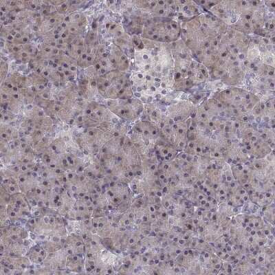 Immunohistochemistry-Paraffin: alcohol dehydrogenase 6 Antibody [NBP2-62658]