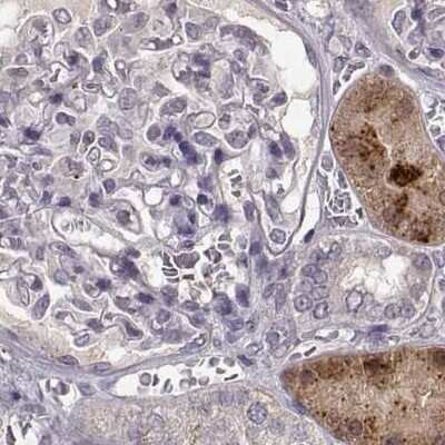 Immunohistochemistry-Paraffin: alcohol dehydrogenase 6 Antibody [NBP2-62658]