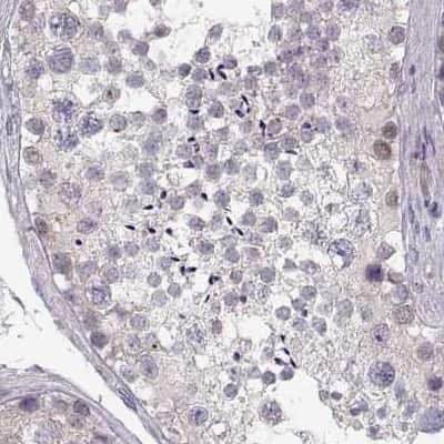 Immunohistochemistry-Paraffin: alcohol dehydrogenase 6 Antibody [NBP2-62658]