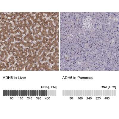 Immunohistochemistry-Paraffin: alcohol dehydrogenase 6 Antibody [NBP2-62661]