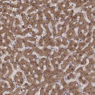 Immunohistochemistry-Paraffin: alcohol dehydrogenase 6 Antibody [NBP2-62661]