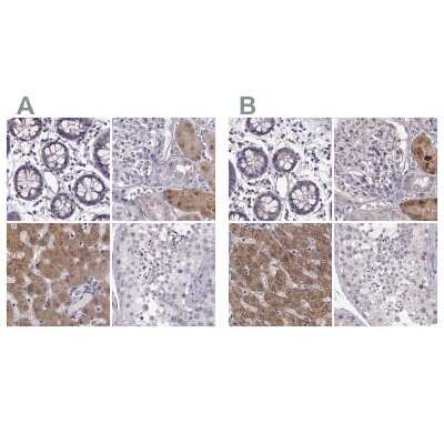 Immunohistochemistry-Paraffin: alcohol dehydrogenase 6 Antibody [NBP2-62661]