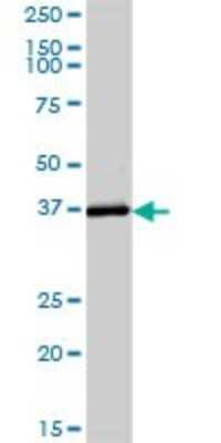 Western Blot: alcohol dehydrogenase 6 Antibody [H00000130-B01P]