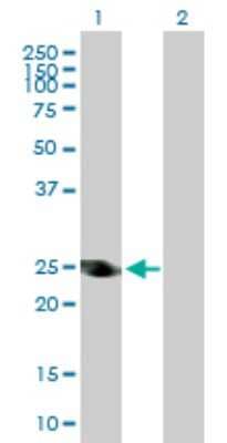 Western Blot: alcohol dehydrogenase 6 Antibody [H00000130-D01P]
