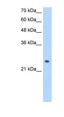 Western Blot: alcohol dehydrogenase 6 Antibody [NBP1-56345]