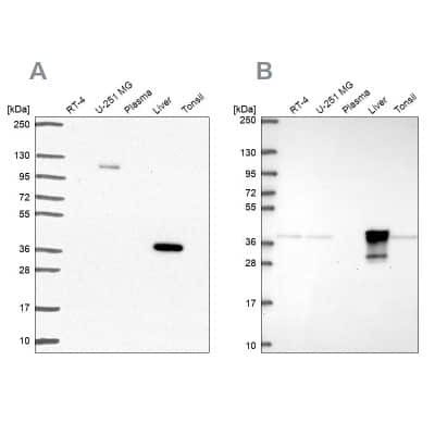 Western Blot: alcohol dehydrogenase 6 Antibody [NBP2-62658]