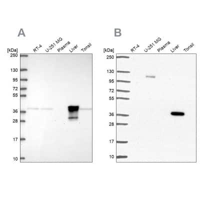 Western Blot: alcohol dehydrogenase 6 Antibody [NBP2-62661]