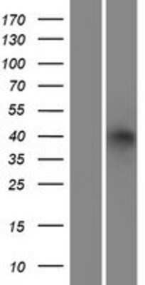 Western Blot: alcohol dehydrogenase 6 Overexpression Lysate [NBP2-10948]