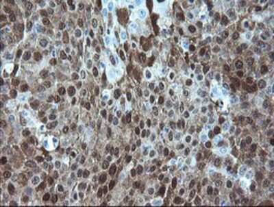 Immunohistochemistry-Paraffin: alcohol dehydrogenase 7 Antibody (OTI2H10) [NBP2-03741]