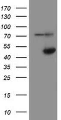 Western Blot: alcohol dehydrogenase 7 Antibody (OTI2H10) [NBP2-03741]