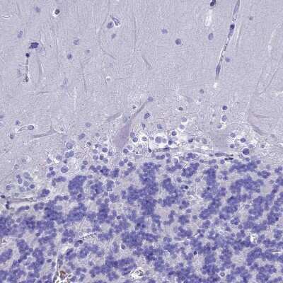 Immunohistochemistry-Paraffin: alcohol dehydrogenase 7 Antibody [NBP1-90232]