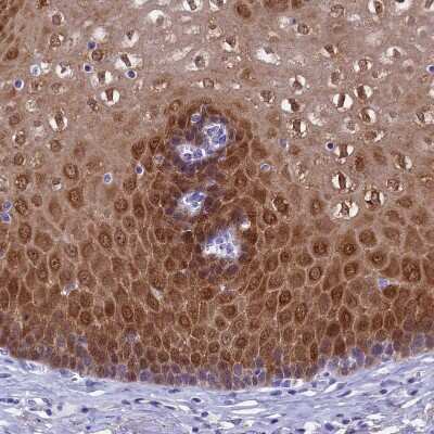 Immunohistochemistry-Paraffin: alcohol dehydrogenase 7 Antibody [NBP1-90232]
