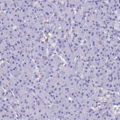 Immunohistochemistry-Paraffin: alcohol dehydrogenase 7 Antibody [NBP1-90232]