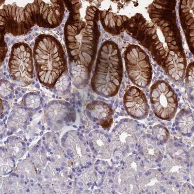 Immunohistochemistry-Paraffin: alcohol dehydrogenase 7 Antibody [NBP1-90232]