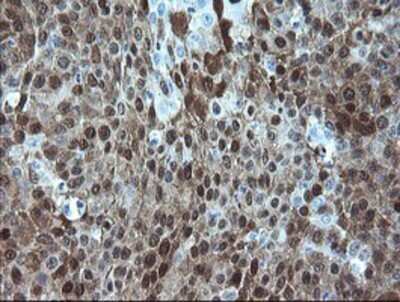 Immunohistochemistry: alcohol dehydrogenase 7 Antibody (OTI2H10) - Azide and BSA Free [NBP2-70098]