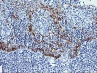 Immunohistochemistry: alcohol dehydrogenase 7 Antibody (OTI2H10) - Azide and BSA Free [NBP2-70098]