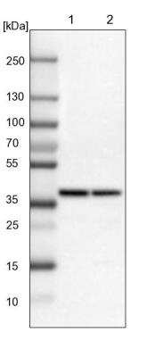 Western Blot: alcohol dehydrogenase 7 Antibody [NBP1-90232]