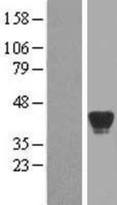 Western Blot: alcohol dehydrogenase 7 Overexpression Lysate [NBP2-10696]