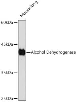 Western Blot: alcohol dehydrogenase Antibody (1X3C0) [NBP3-15822]