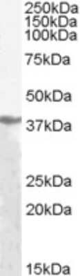 Western Blot: alcohol dehydrogenase Antibody [NB300-956]